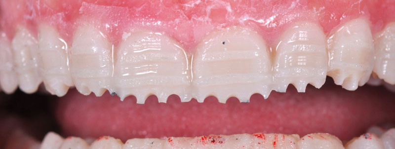 biomatériaux dentaires cours de batterie