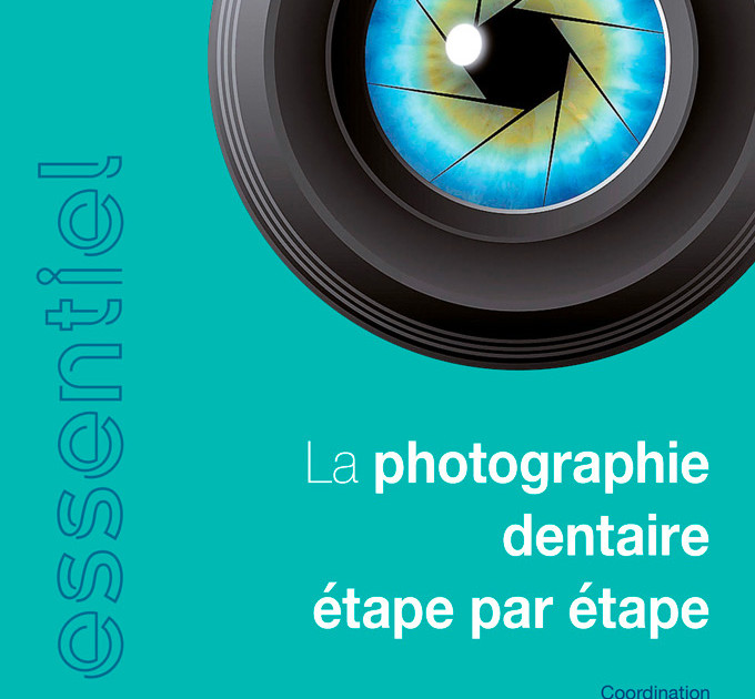 Healifty Lot de 5 Miroirs buccaux pour photographie dentaire, stomatoscopes  : : Commerce, Industrie et Science