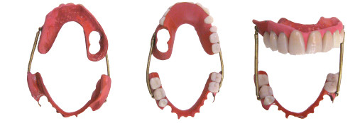 Une révolution en prothèse dentaire : Les dents artificielles minérales -  SFHAD