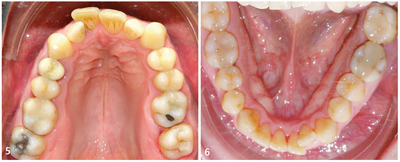 Modèle anatomique de mâchoire - CM0004 - SATC solution - de dentition /  dentaire / de formation