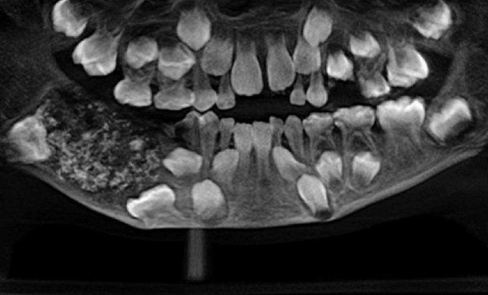 5 miroirs dentaires Double face, endodontie, photo – Grandado