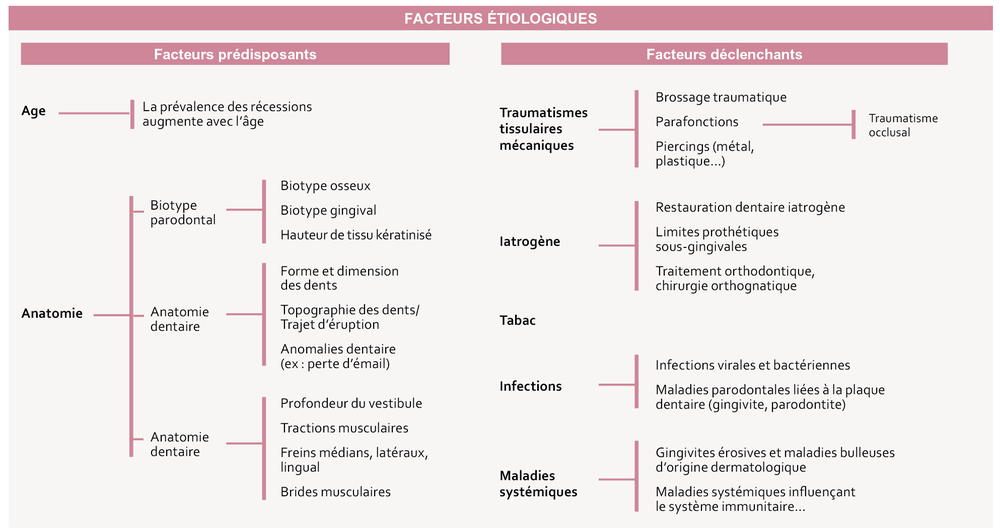 classification des récessions gingivales