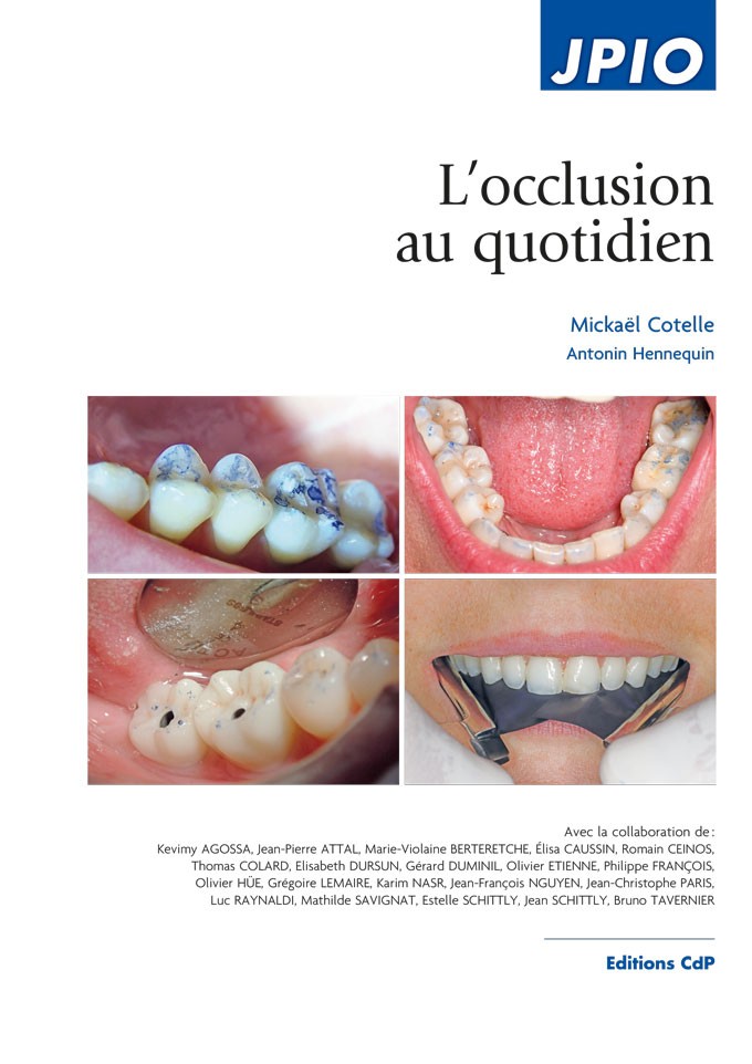 L’occlusion au quotidien