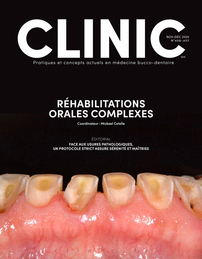 CLINIC- Novembre/Décembre 2025<br/> Réhabilitations complexes dento-portées